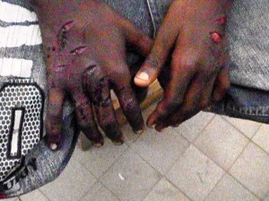 les mains incisées de L. Mavinga/Photo Franck Mbayi