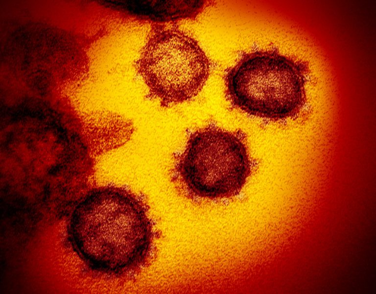 Le troisième congolais atteint de coronavirus est un septuagénaire venu de Swisse